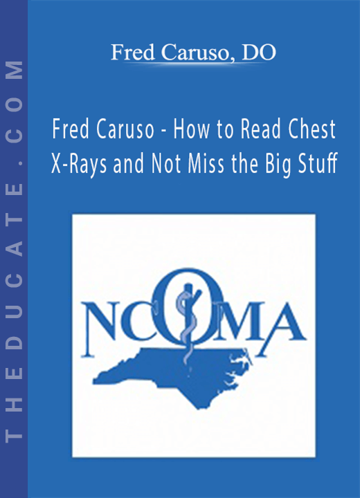 Fred Caruso - How to Read Chest X-Rays and Not Miss the Big Stuff - Fred Caruso, DO
